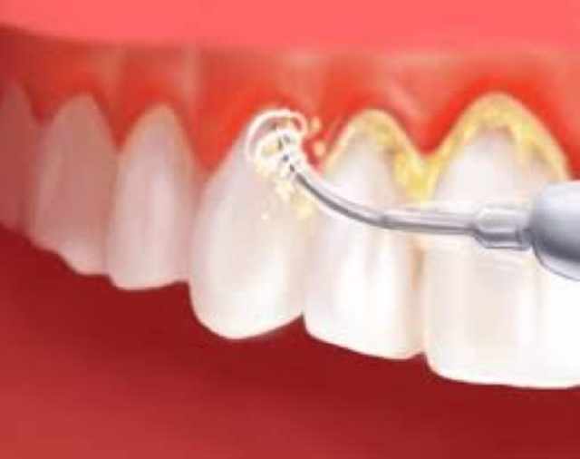 Foto 1 - Clinica de odontologia ideal sorriso embu